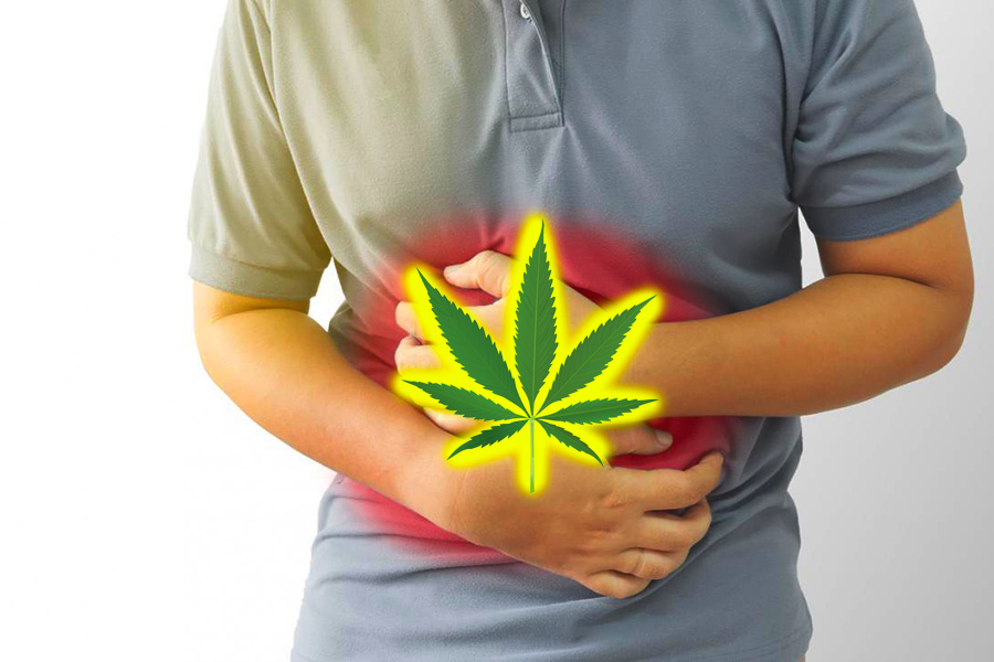 Effetti della cannabis sul sistema gastrointestinale